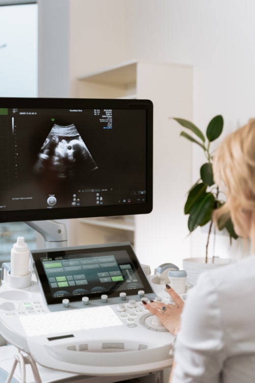 Ultrasound technician using an ultrasound machine that has a baby on the screen
